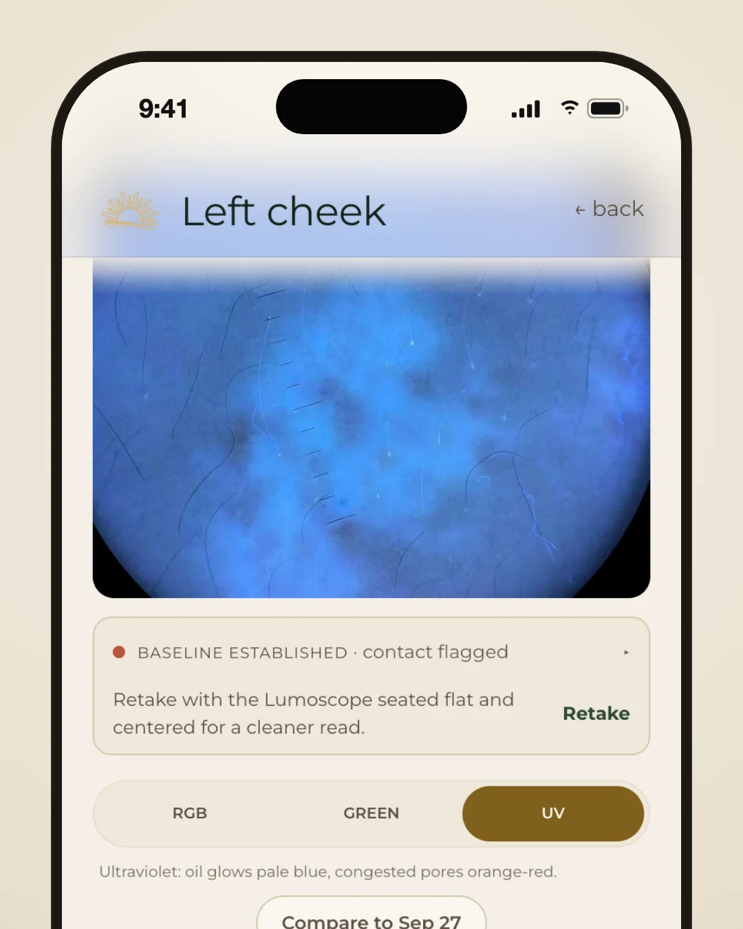 Lumeria app scan result for the left cheek showing its UV photo, a blue-lit view of the skin, with the UV option selected in the RGB, Green and UV switch below.