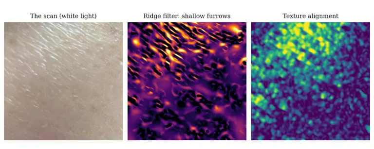 Three panels of the same patch of skin: the white-light scan, a ridge-filter map highlighting shallow diagonal furrows in orange on purple, and a texture-alignment map that is brightest where those furrows run in parallel.