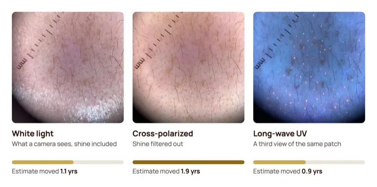 The same patch of skin under white light, cross-polarized light and long-wave UV, each with a bar showing how far blurring that view moved the model's age estimate: 1.1 years, 1.9 years and 0.9 years.